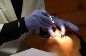 Zuby a návšteva u zubára