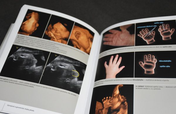 Tehotenstvo v obrazoch kniha